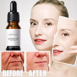 Instant Perfection Wrinkles Essence (BUY 2 GET 1 FREE NOW)